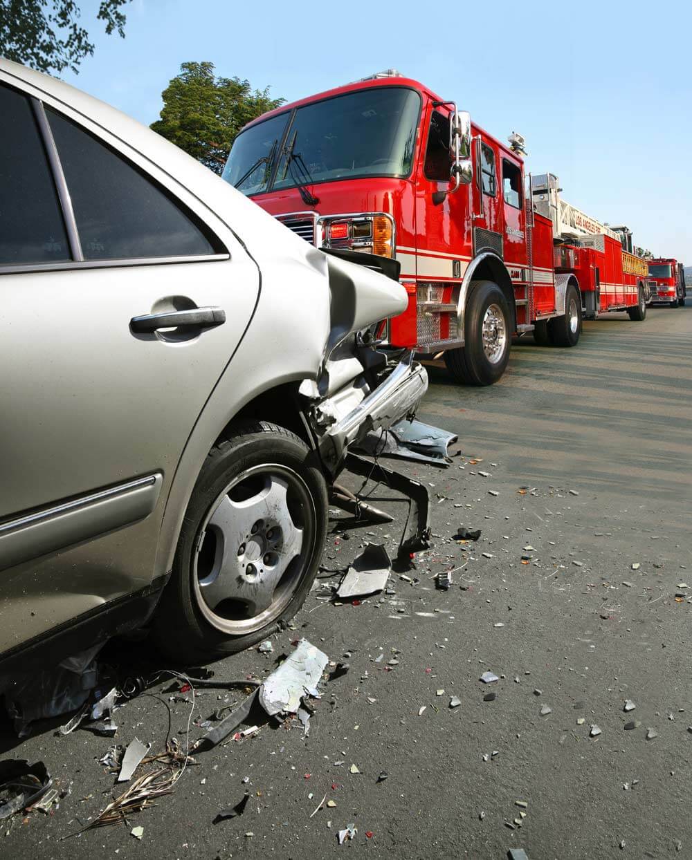 Catastrophic Accident Benefits | Grillo Law Personal Injury Lawyers