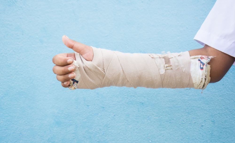 Common Motorcycle Accident Injuries_ Injuries to Upper Extremities (Arms, Elbows, Wrists), Torso, Spine