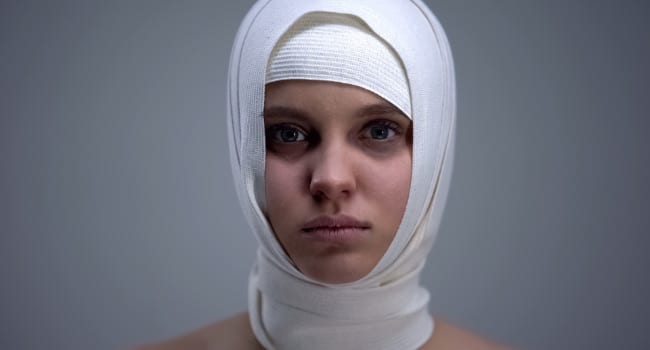 Physical and Psychological Impairments that Result in a Catastrophic Injury